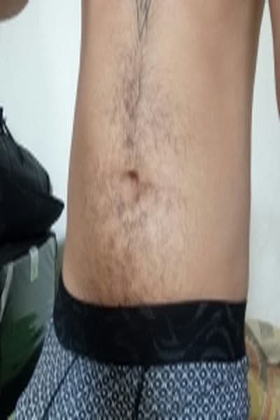 Vnsr